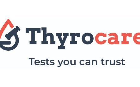 Thyrocare Q4FY25 Revenue Up 21 Percent YoY to Rs 187.2 Cr; PAT Rises 24 Percent to Rs 21.3 Cr
